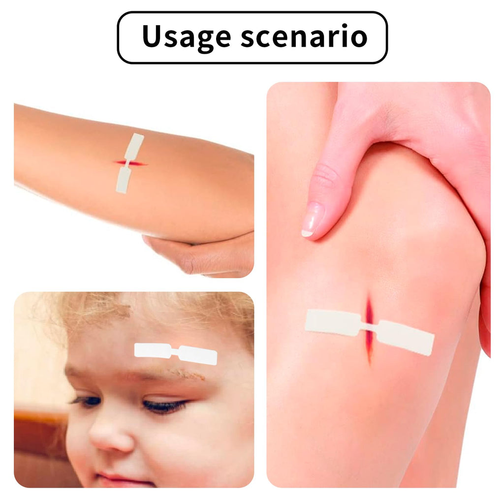 120pcs Butterfly Closure Strips Waterproof Adhesive Wound Closure Bandages for Small Wound