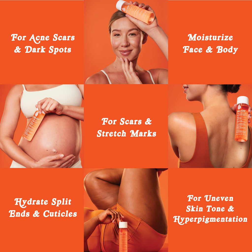 Bio-Oil Skincare Body Oil, Moisturizer for Scars and Stretchmarks, Hydrates Skin, Non-Greasy, Dermatologist Recommended, Non-Comedogenic, For All Skin Types, with Vitamin A, E, 4.2 Ounce (Pack of 1)