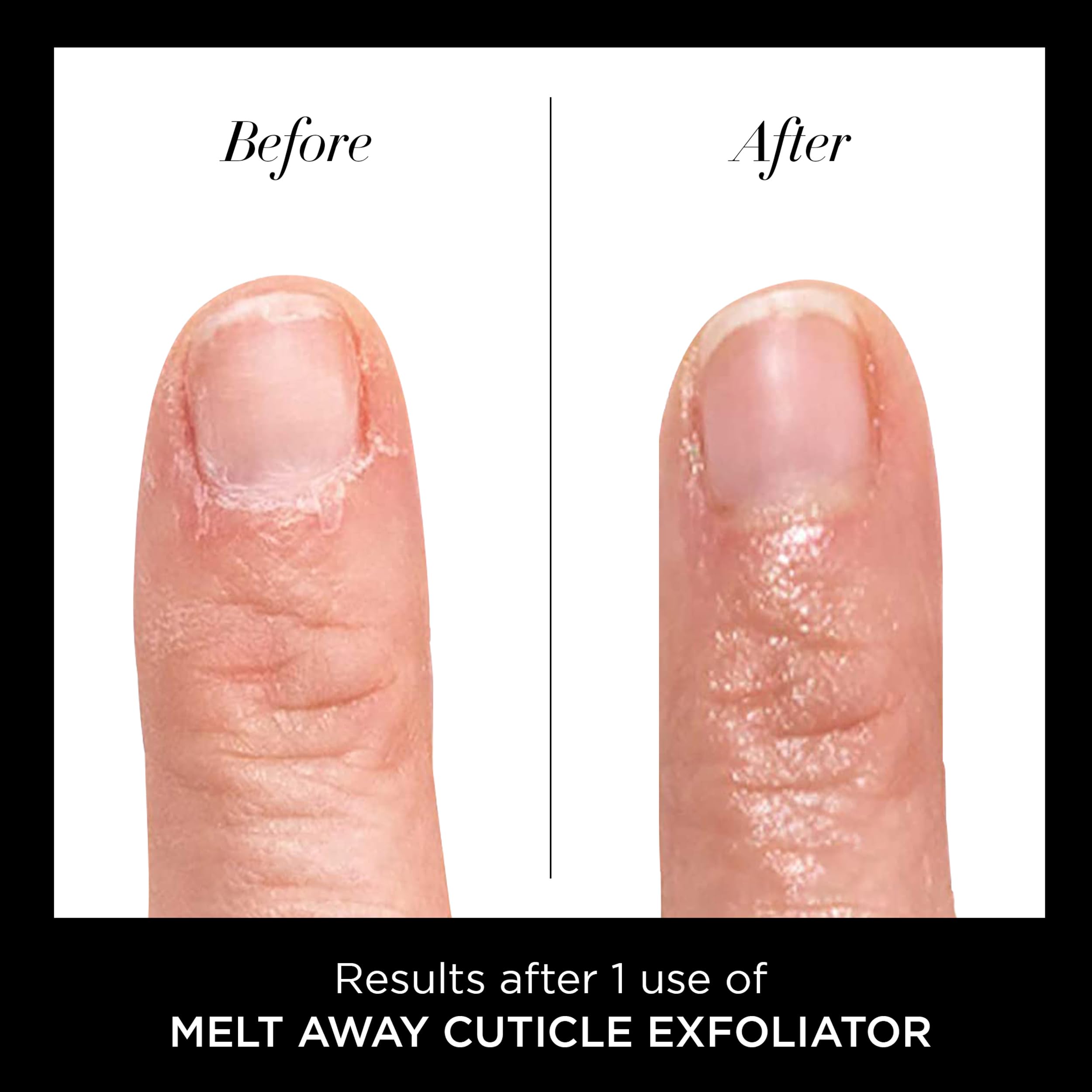 butter LONDON Cuticle Remover Liquid, Melt Away - Cuticle Oil Exfoliator & Softener Gently Removes Dry, Overgrown Cuticles for Healthy Looking Nails - Fast-Acting & Pain-Free Formula - 0.4 Fl Oz