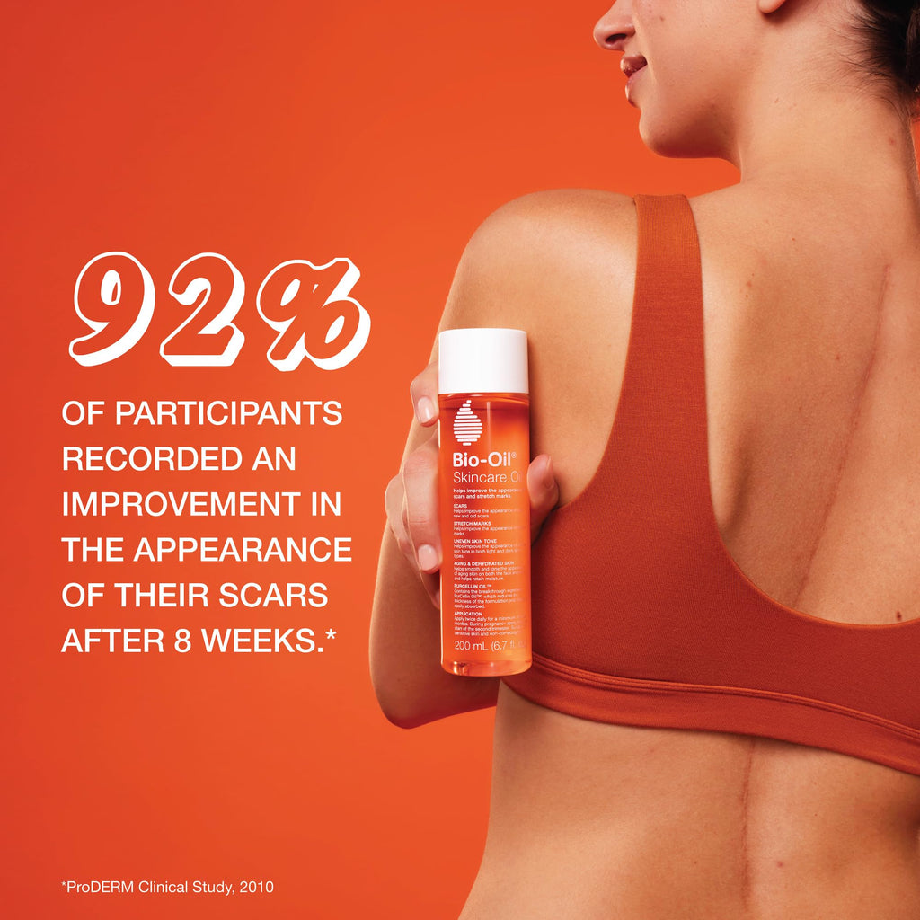 Bio-Oil Skincare Body Oil, Moisturizer for Scars and Stretchmarks, Hydrates Skin, Non-Greasy, Dermatologist Recommended, Non-Comedogenic, For All Skin Types, with Vitamin A, E, 4.2 Ounce (Pack of 1)